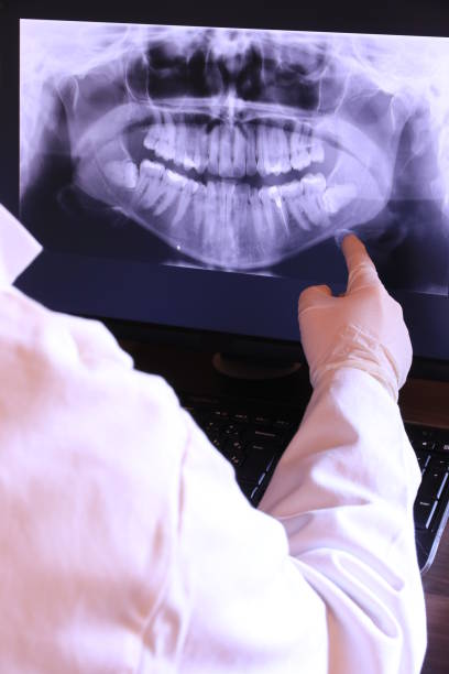 Best Emergency Wisdom Teeth Removal in Belton, SC